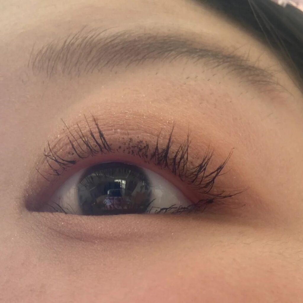 A woman shows her damaged upper eyelashes after extensions, with some natural lashes falling out