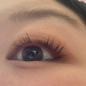 A woman shows her damaged upper eyelashes after extensions, with some natural lashes falling out