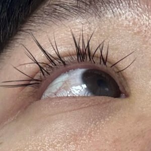 Adverse lash extension outcome - Partial detachment with asymmetric shedding pattern