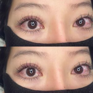 Young woman with active stye wearing lash extensions against medical advice